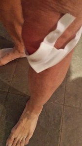 Lesser of Man maybe hospitalized . LOL