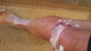 Another ripped apart knee. I think I have a stone caught under the skin though.
