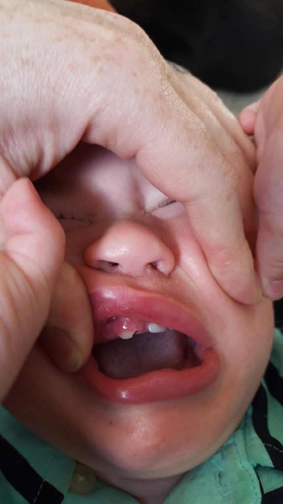 Second little incident for August. Kids ! LOL 